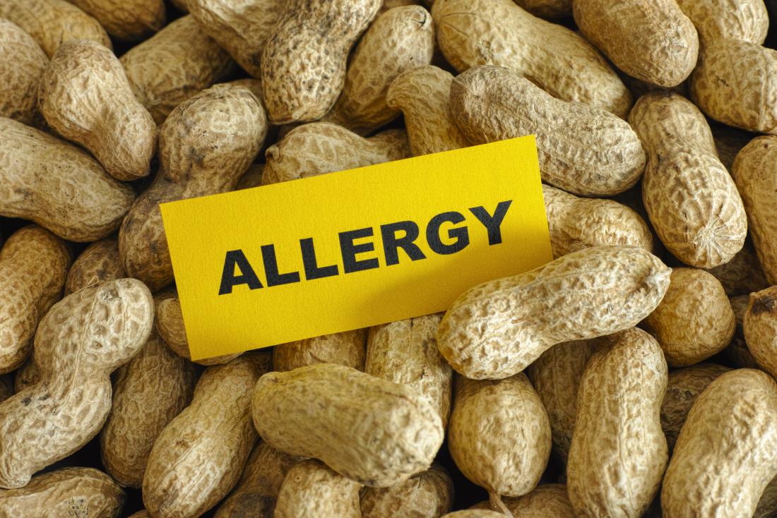 How to Travel with a Peanut Allergy - Seat Sitters Guide